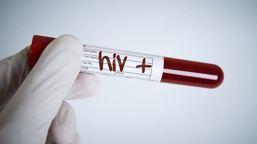 В Германии медики полностью вылечили от ВИЧ очередного пациента